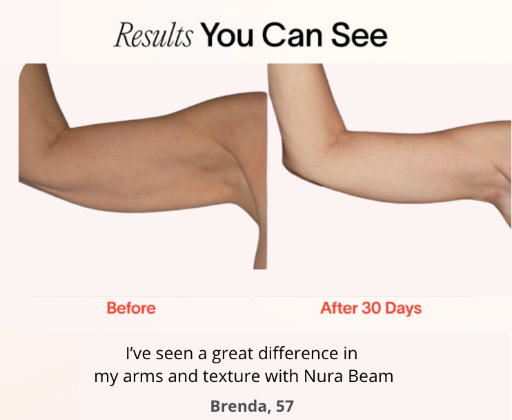 NuraSculpt™ Arm Bands
